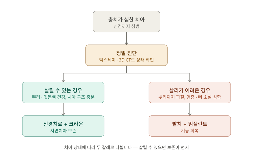 충치가 심한 치아의 치료 결정 흐름도 — 신경치료와 임플란트 갈림길