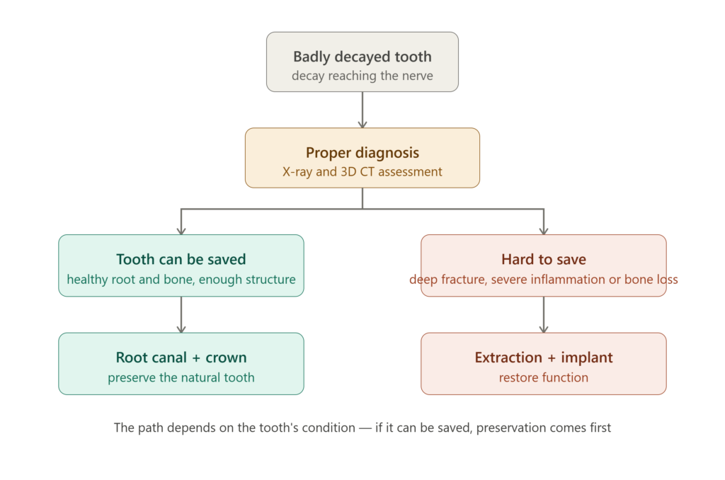Decision flow for a badly decayed tooth: root canal and crown versus extraction and implant